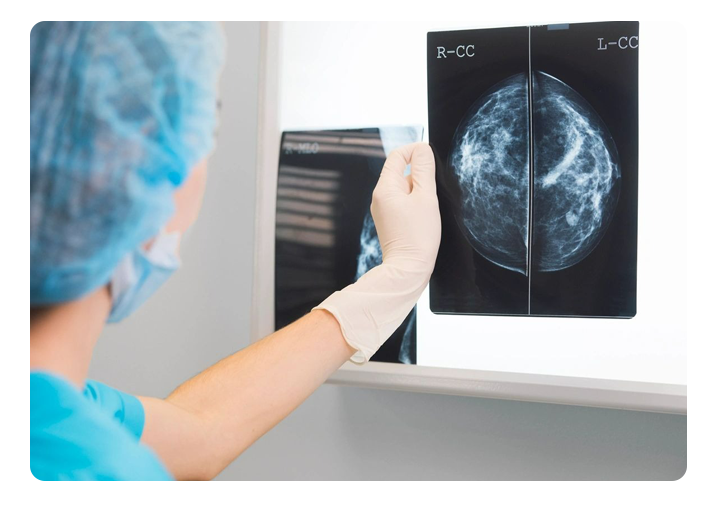 A doctor looking at an x-ray of a breast.