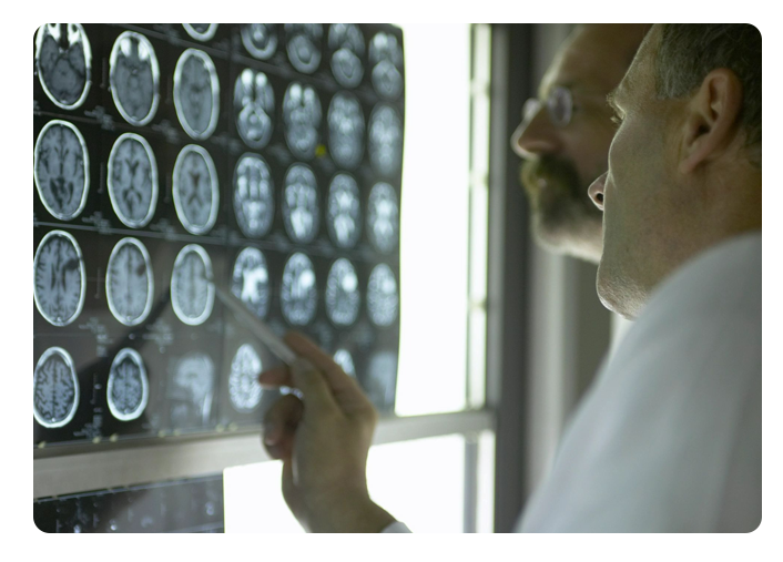 A man looking at an x-ray of his head.